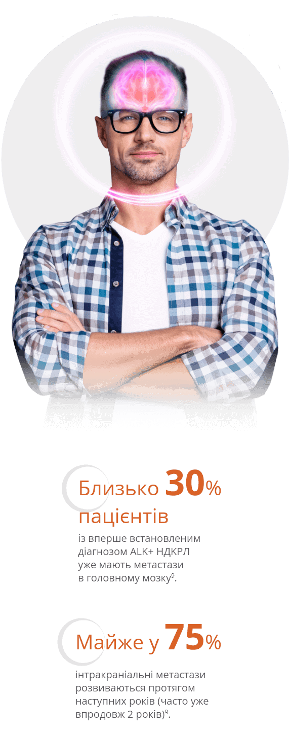 Близько 30% пацієнтів із вперше встановленим діагнозом ALK+ НДРЛ уже мають метастази в головному мозку.