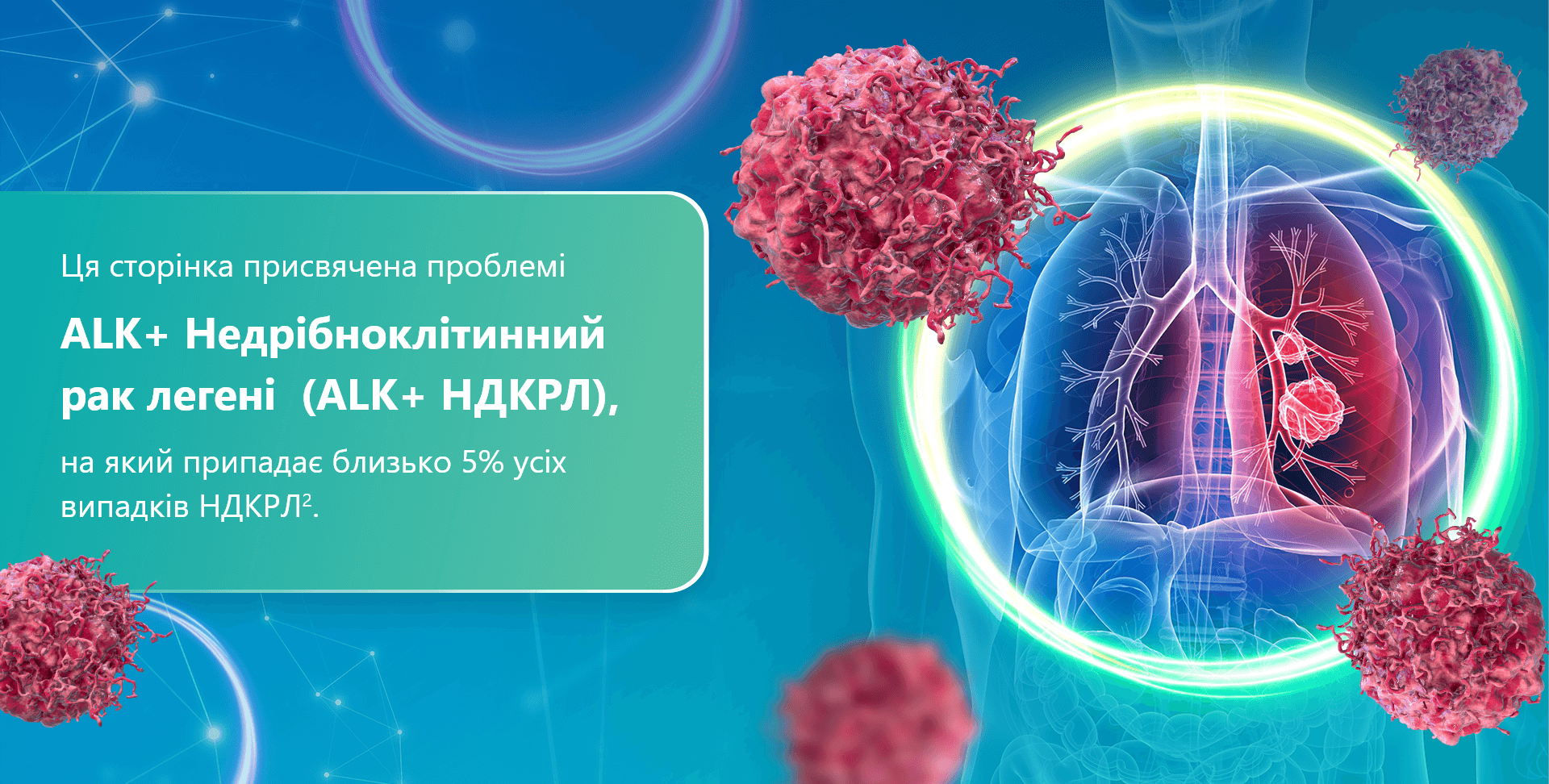 cancer