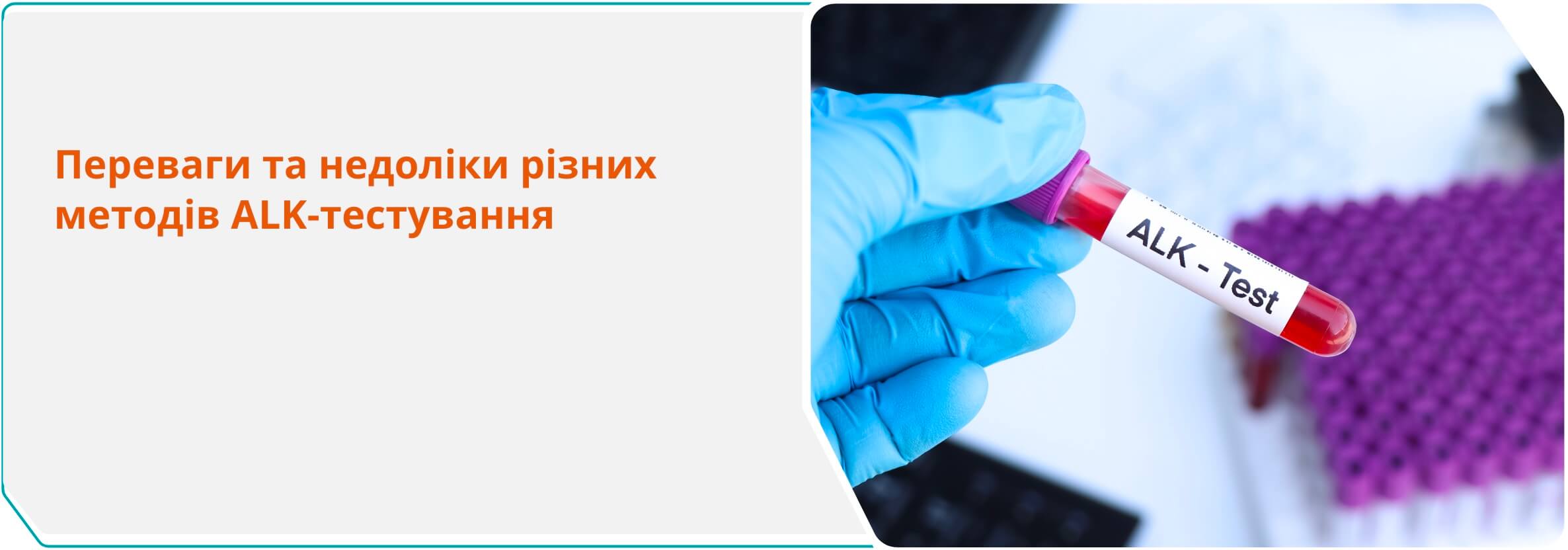 Переваги та недоліки різних методів ALK-тестування