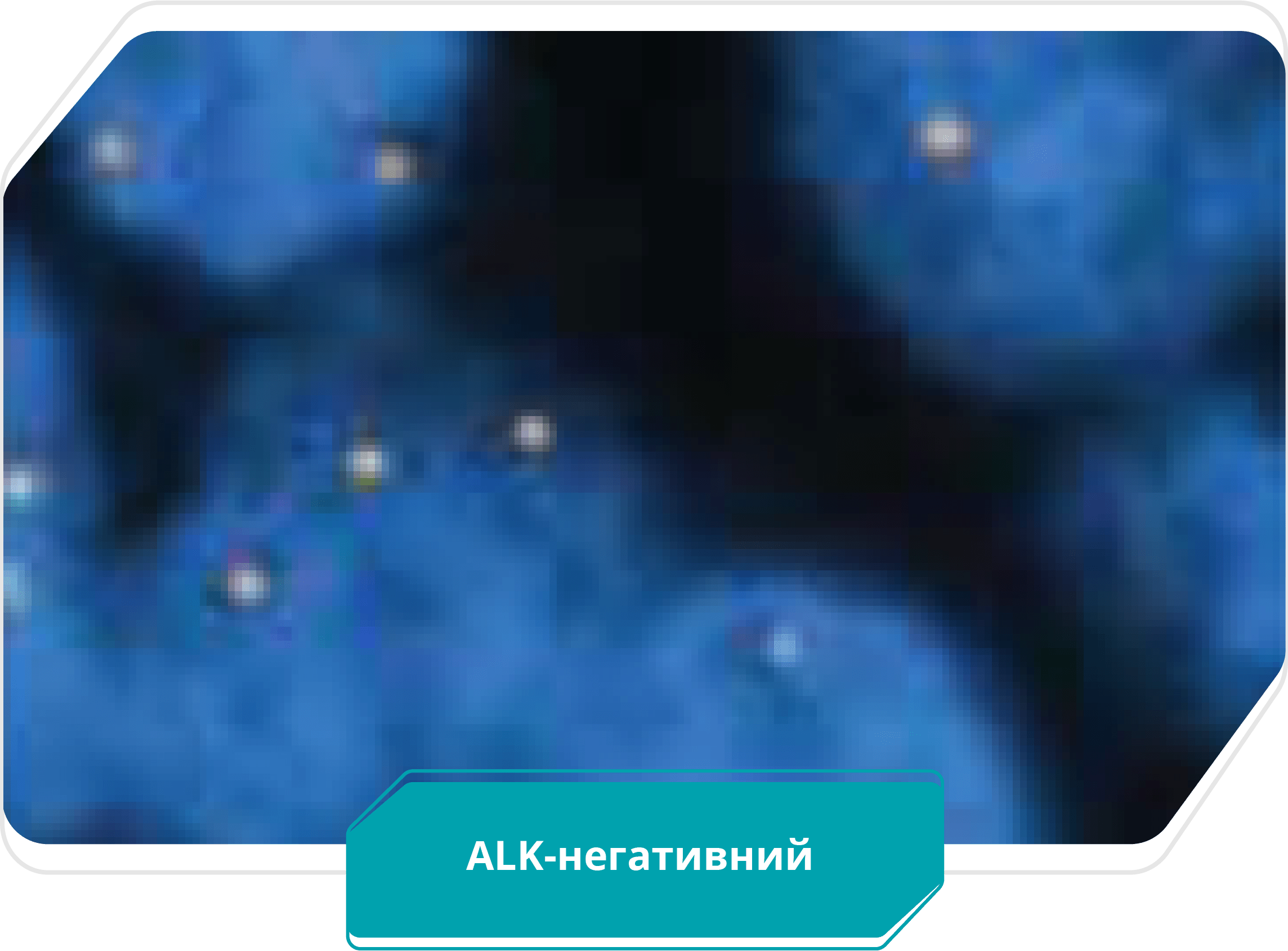 ALK-негативний