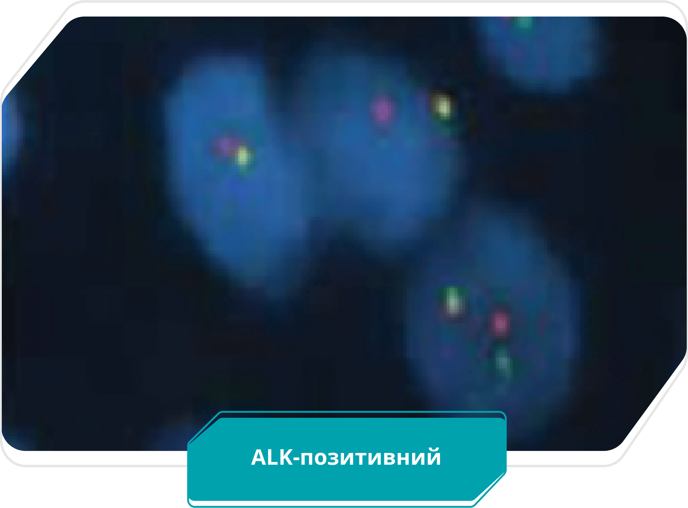 ALK-позитивний
