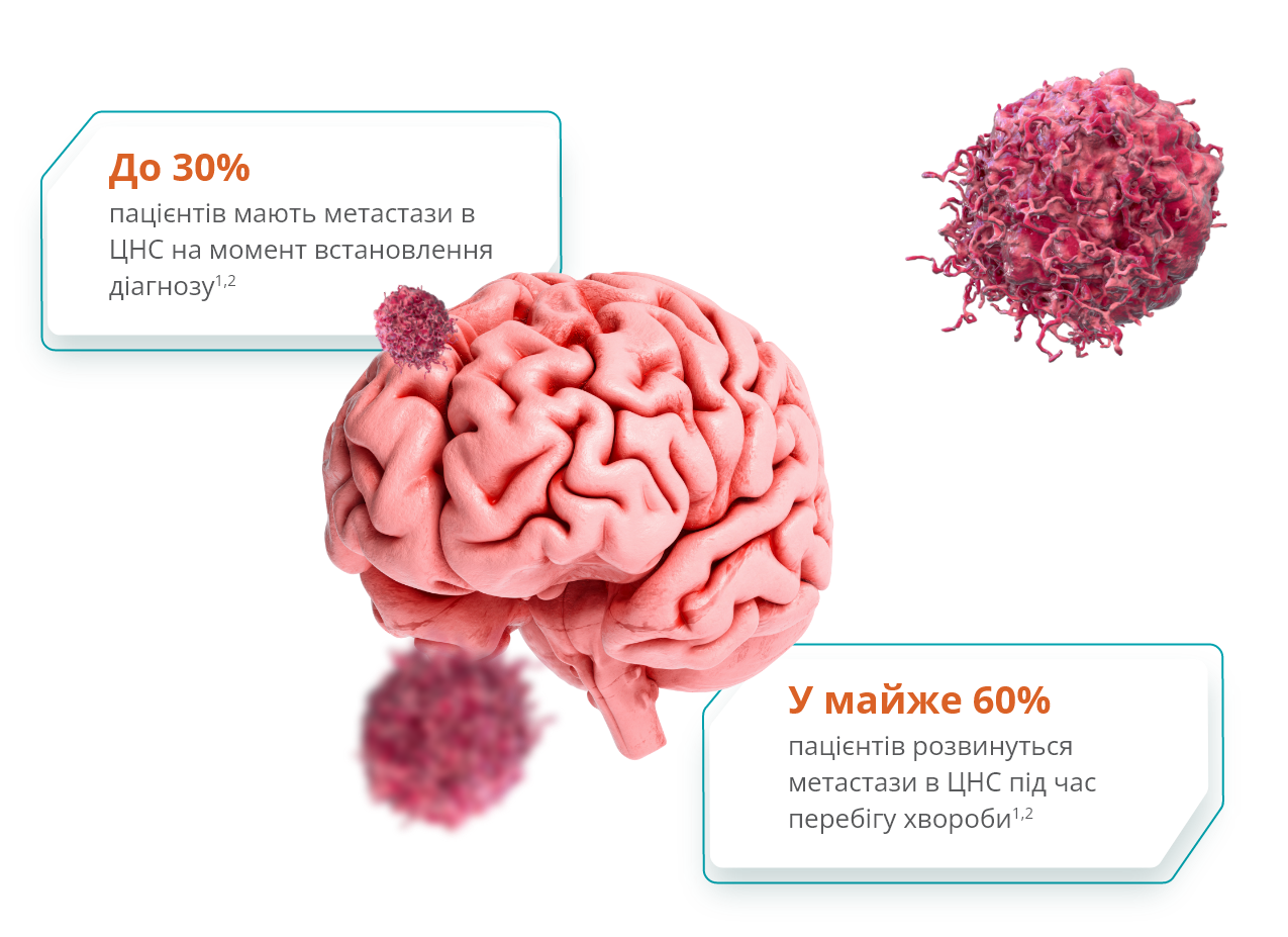 Метастази
